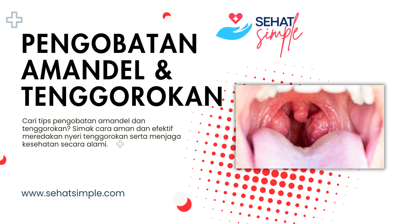 Tips Pengobatan Amandel & Tenggorokan Paling Ampuh – SehatSimple