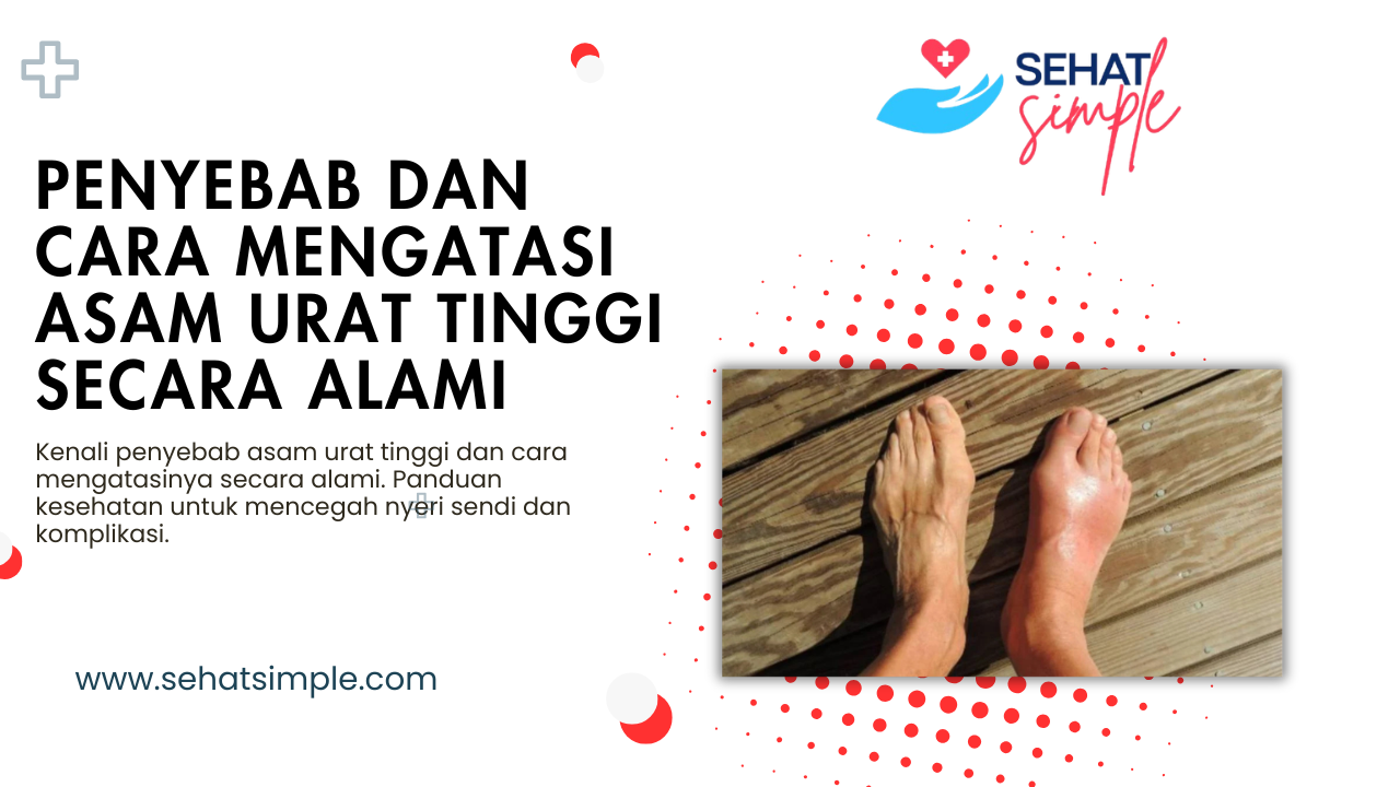 Info Kesehatan: Penyebab dan Cara Mengatasi Asam Urat Tinggi Secara Alami
